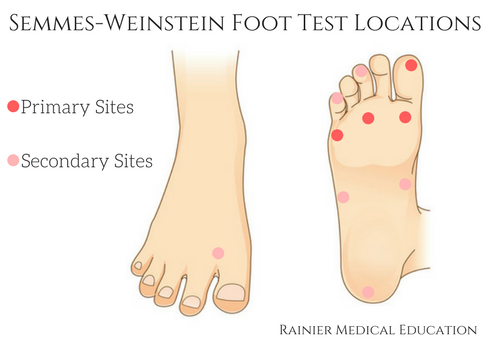 foot locations for semmes-weinstein monofilament test